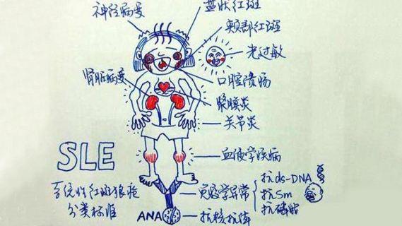 宝宝系统性红斑狼疮症状图片:您知道儿童系统性红斑狼疮的症状有哪些吗？