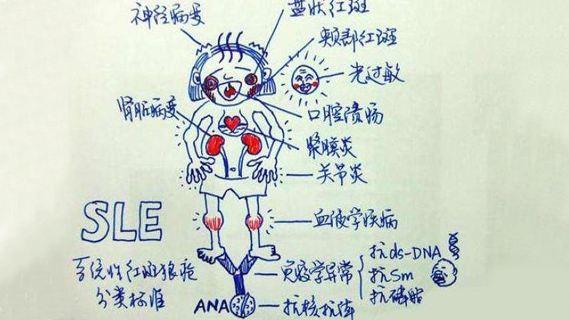 宝宝系统性红斑狼疮症状图片:您知道儿童系统性红斑狼疮的症状有哪些吗？