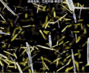 关节炎症状:髋关节炎主要的症状表现？
