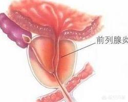 男性按摩壮阳视频教程，男性怎么锻炼PC肌？有什么好的办法吗？