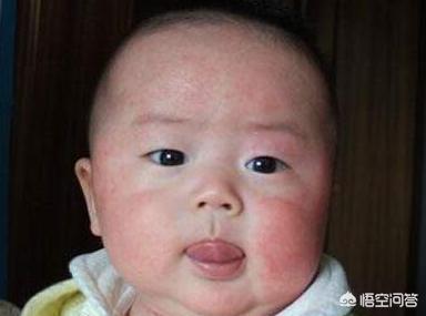 5岁宝宝老是干咳嗽怎么办:5岁儿童喉咙痒干咳嗽怎么办 五岁小孩经常咳嗽，每个月都有几天，该怎么办？