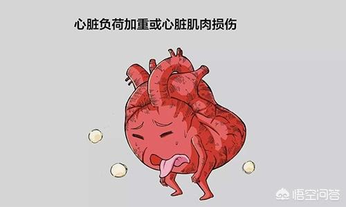 充血性心力衰竭临床诊断依据:急性充血性心力衰竭临床诊断依据 有没有什么办法在家里也能迅速诊断出充血性心衰？