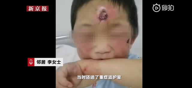 颜艳红虐童:面对黑龙江曲婷婷虐童一案有什么想说的？