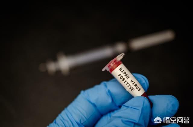 牛病毒种类:病毒的种类有多少种 牛打疫苗后几天打虫子可以？