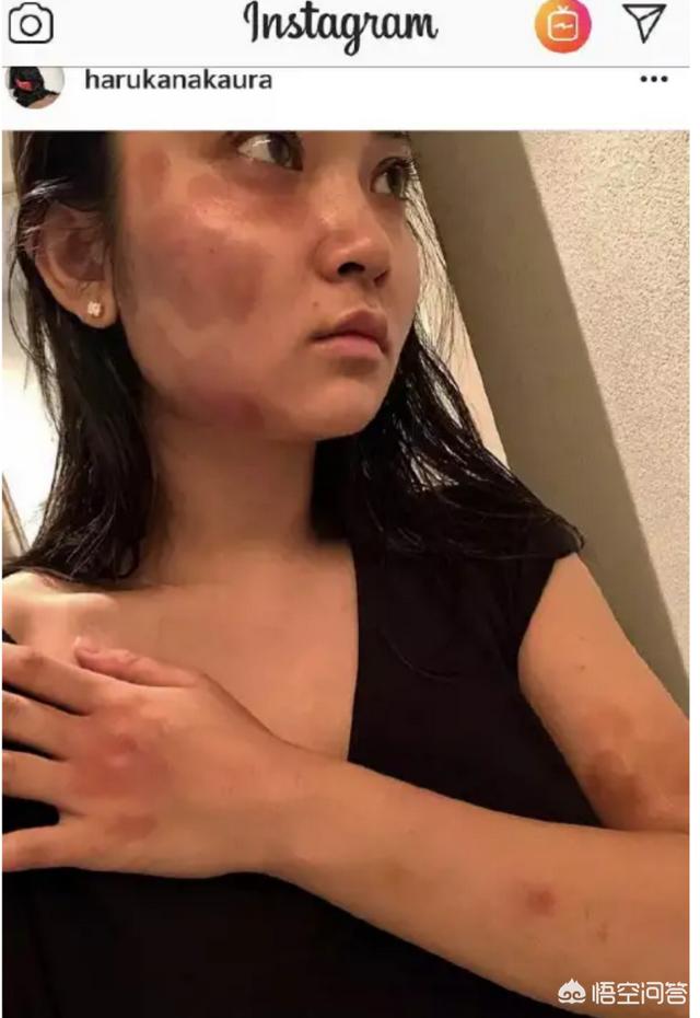 蒋劲夫否认家暴:蒋劲夫家暴获赞，家暴该被原谅吗你怎么看