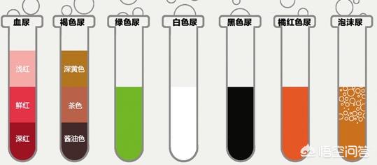 头条问答 不同颜色尿液是否预示不同疾病 远行健康的回答 0赞