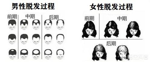 为什么女性偏爱秃头男性？