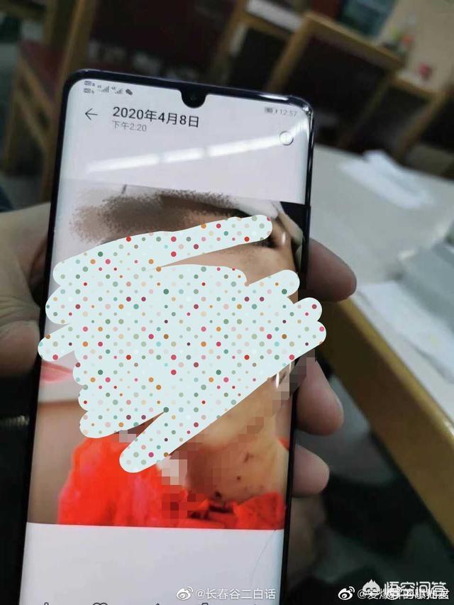 颜艳红虐童:面对黑龙江曲婷婷虐童一案有什么想说的？
