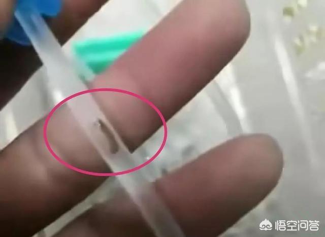 3岁幼儿在乐山人民医院输液,输液管中疑似有虫,孩子后背出现小红点；涉事输液袋被封存,院方暂未回应。你怎么看？