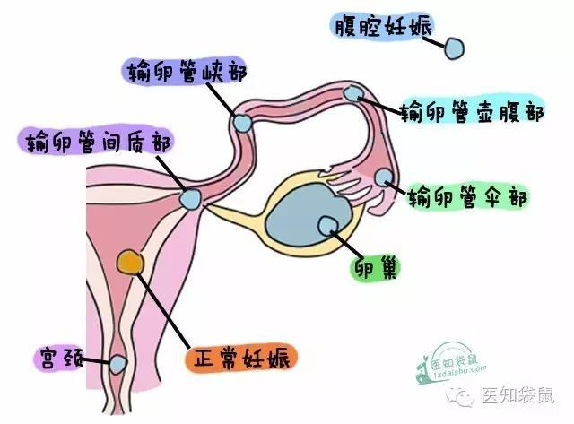 头条问答 怀孕前期有时小腹会疼 就跟痛经差不多 这是什么原因 45个回答