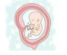 孕期妈妈补碘方法有哪些，孕妈补充DHA该怎么吃，怎么补