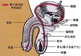 他因手术失败男性器官被毁，什么是男性结扎手术对男性身体有危害吗