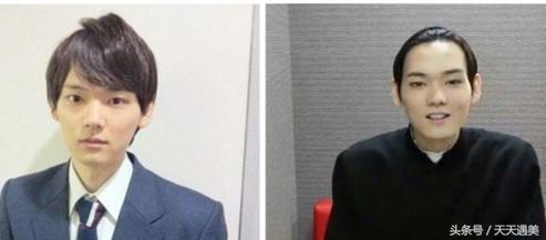 林俊杰发型图片:为什么林俊杰不愿意露自己的额头
