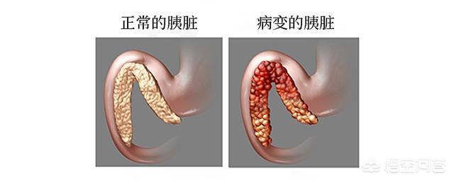 狗狗吞21个奶嘴手术时惊呆医生:胰腺罢工！狗狗情况危急？