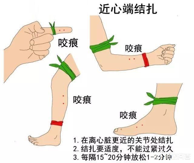 头条问答 - 看到大型蛇类应该怎么办?(133个回答)
