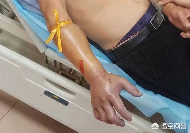 森林王蛇:农村里蛇越来越多，种什么植物可以防止夏天蛇进院子？