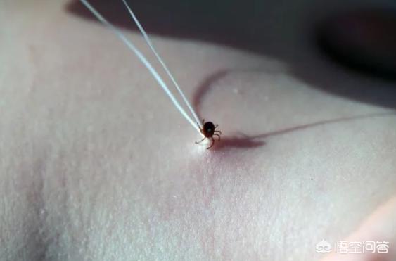 给睥虫咬了:刚被蜱虫咬，就把它拿掉了，要紧吗？