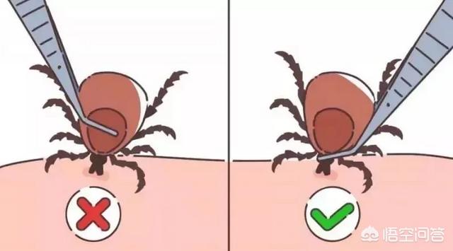给睥虫咬了:刚被蜱虫咬，就把它拿掉了，要紧吗？