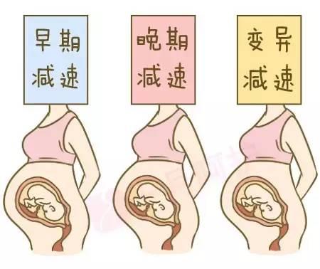 胎心监护评分：胎心监护评分标准