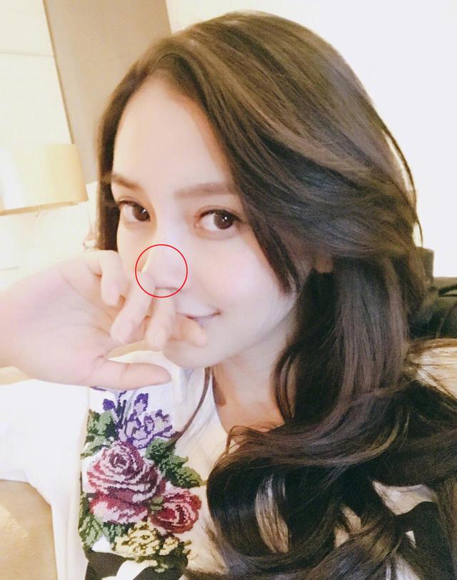 贾青整容:整容最成功的女明星是谁？
