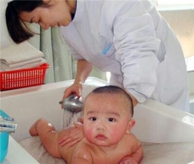 宝宝患湿疹，多是饮食不注意，妈妈如何应对宝宝湿疹？