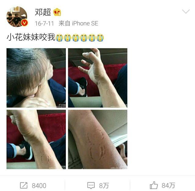 邓超调侃杨紫:综艺节目中，哪些“尴尬”画面让你见一次笑一次