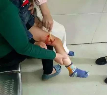六岁女童被恶狗咬死:名狗撕咬小孩，路人拿工具打狗致狗死，被索赔十多万，你怎么看？