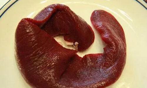 请问,猪连体是什么呢？