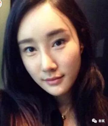 崔始源的妹妹:整容上瘾或者过度整容会对人有什么影响？