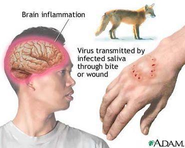 日本狂犬病发病率:被小狗咬了，没注射疫苗，这种情况会患狂犬病吗？ 日本狂犬病发病率为何低