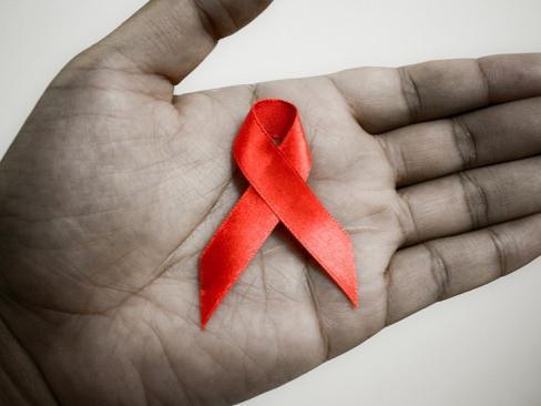 艾滋病是什么,艾滋病的早期症状是什么？