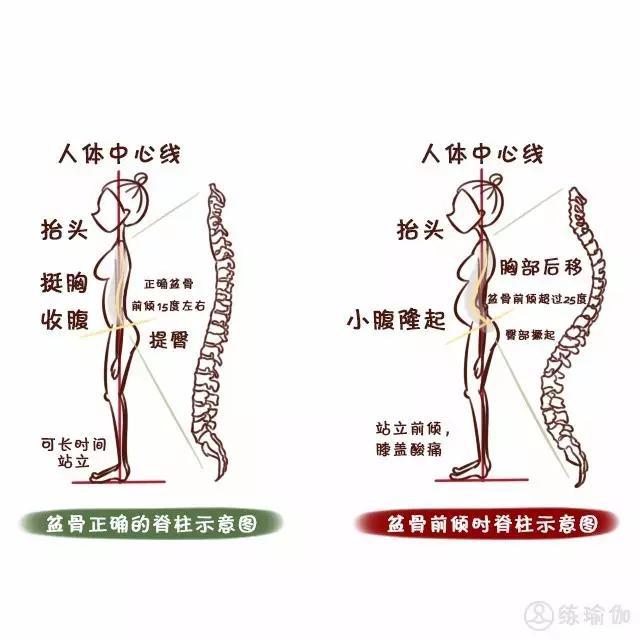 怎么改善骨盆前倾后倾？