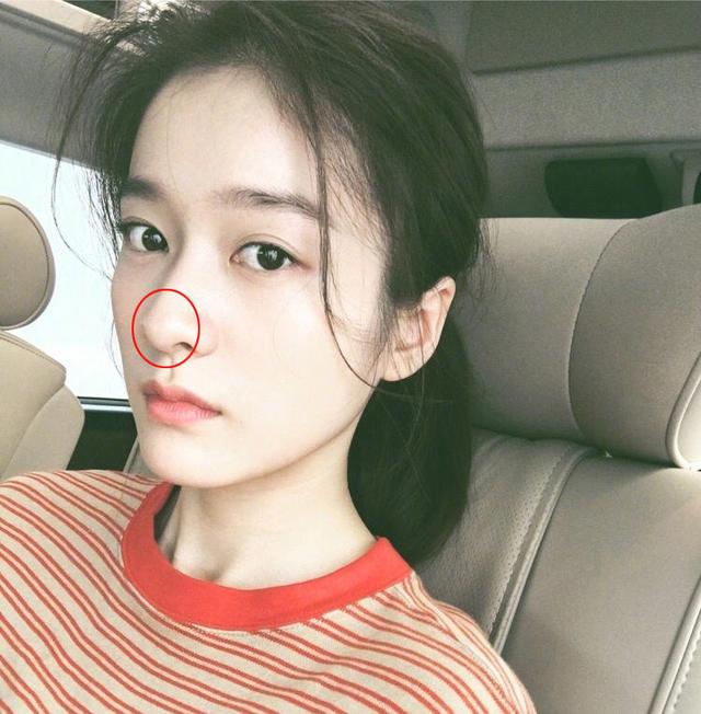 贾青整容:整容最成功的女明星是谁？