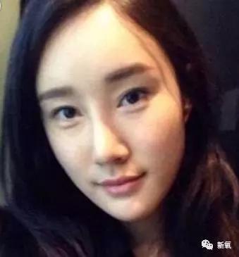 崔始源的妹妹:整容上瘾或者过度整容会对人有什么影响？