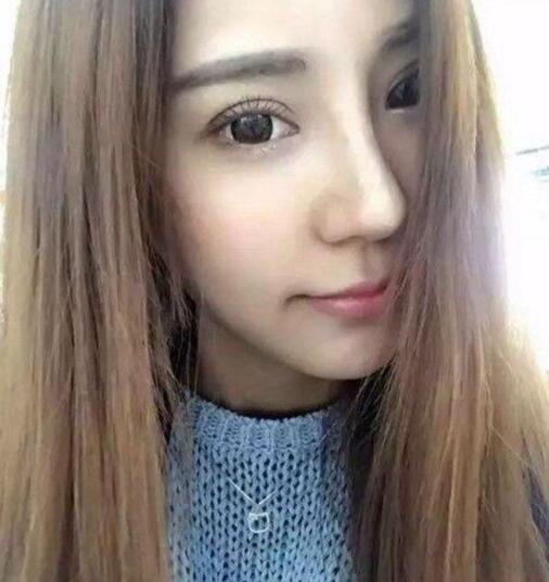 金晨整容呀对比:又有一女孩花百万整成迪丽热巴，大家怎么看待整容？