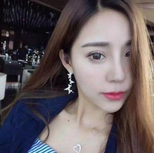 金晨整容呀对比:又有一女孩花百万整成迪丽热巴，大家怎么看待整容？