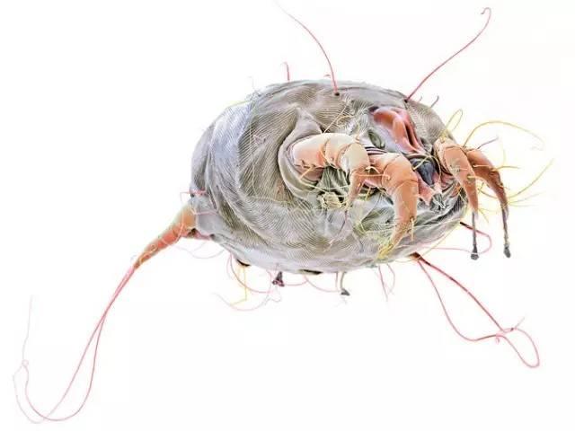 螨虫感染:人一般会感染3种螨虫，是哪3种？