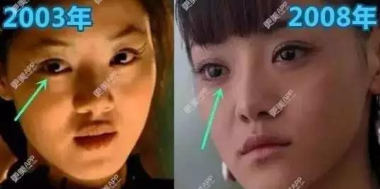 唐悠悠是不是整容了:大家有没有觉得邓家佳越来越像李小璐了？