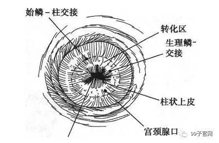 宫颈糜烂治疗好了多久来月经;宫颈糜烂一般治疗多久