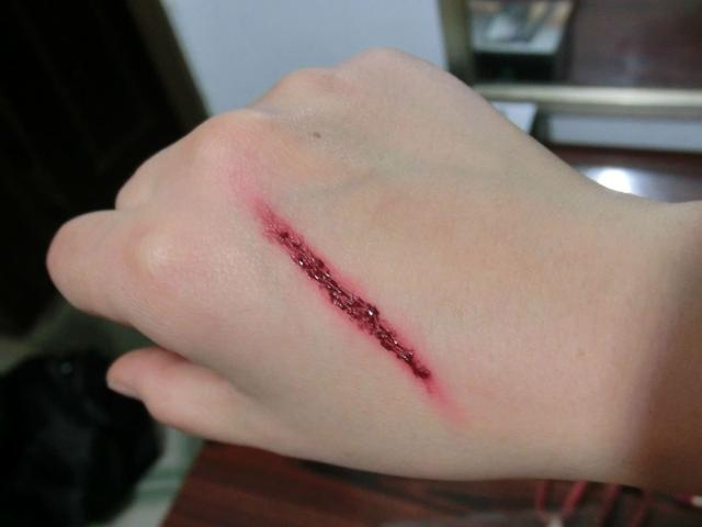 头条问答 - 受伤了,如何不留疤?(9个回答)