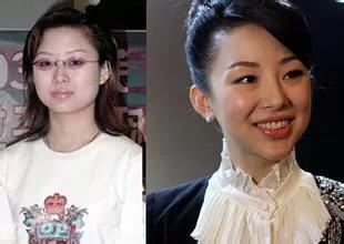 李方丁整容:潘晓婷整容一事是真的假的？