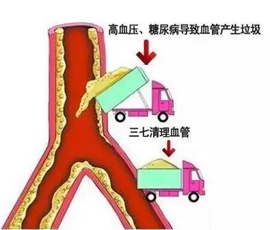 三七的功效与副作用，三七、人参、西洋参的功效分别是什么？谁才是保健中药之王？