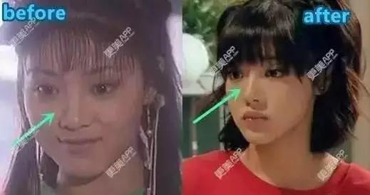 唐悠悠是不是整容了:大家有没有觉得邓家佳越来越像李小璐了？