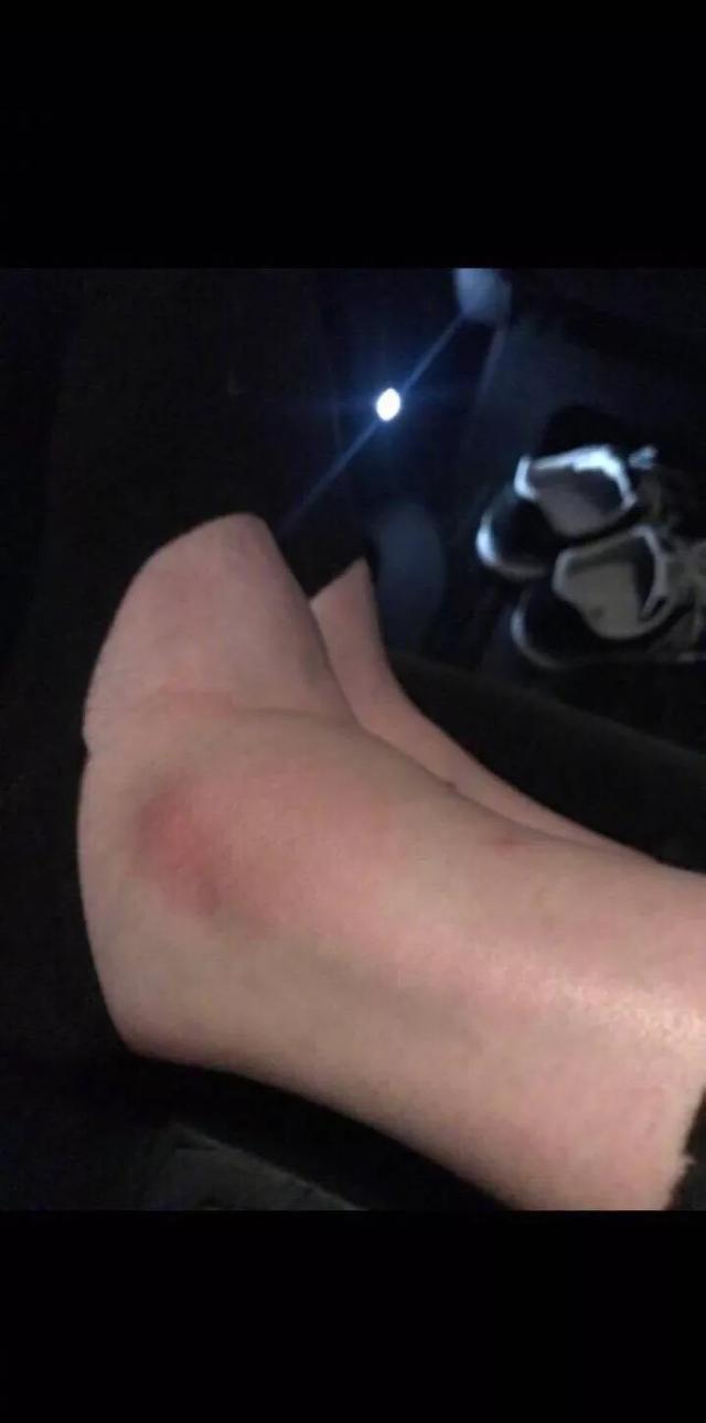 杨幂代言维密:如何看待奚梦瑶摔跤，之后有多大可能继续参加维密