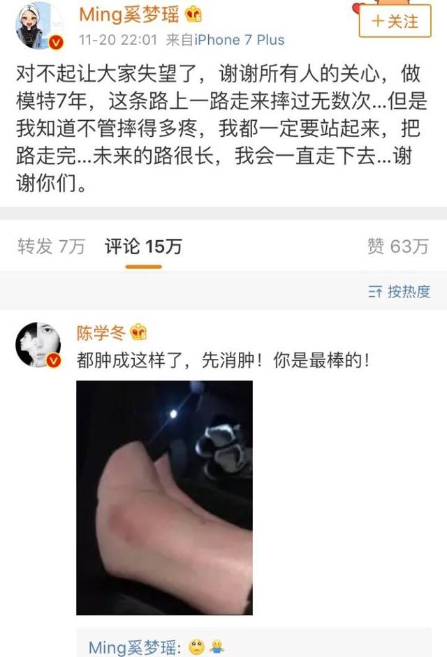 费尔南达 利马:你怎么看待2017维密秀现场奚梦瑶踩到翅膀摔倒在舞台 ？