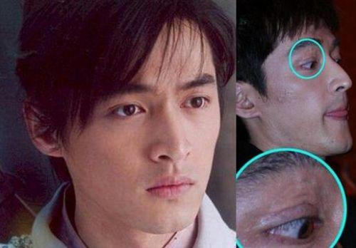 胡歌车祸前后对比图:在娱乐圈内，胡歌和俞灏明车祸复出后，为何差距如此大