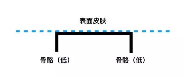 黄金胡子鱼腮部往下凹陷:黄金胡子鱼为什么无缘无故的死了？