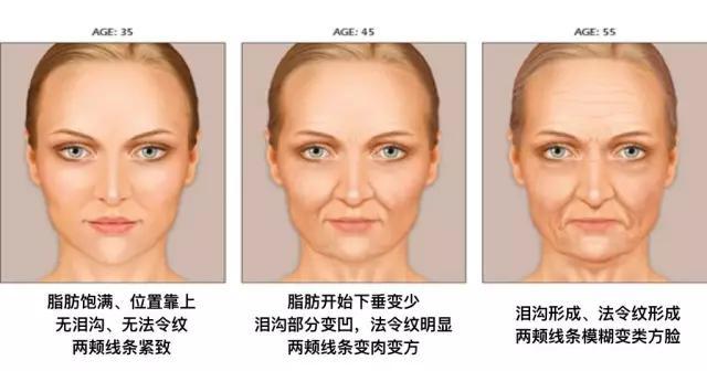 阿sa照片:阿娇和阿sa是怎么认识并走到一起的