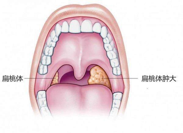 三门相通会死人,人类离开哪个器官不会死亡？