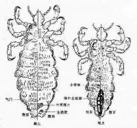 新生儿虱子是怎么产生的:第一个虱子是怎么产生的 为何在当今社会，宝宝头上会长虱子？